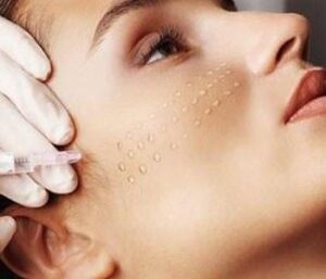beautifox-biorevitalization