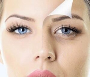 beautifox-mesotherapy-contradictions